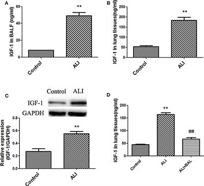 Alveolar Epithelial Cells Promote IGF-1 Production by Alveolar Macrophages Through TGF-β to Suppress Endogenous Inflammatory Signals